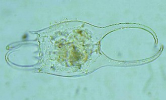 Imagem microscópica do Brachionus_falcatus_zacharias