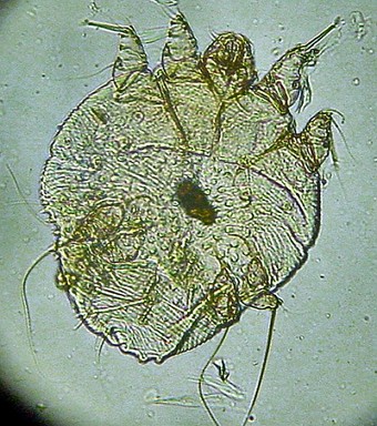 ácaro-da-sarna imagem ampliada de um ácaro-da-sarna