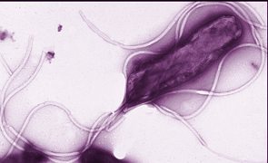 Imagem de microscópio da Helicobacter pylori