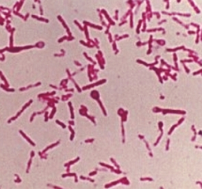 imagem de bactérias do tétano