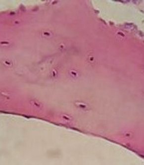 Imagem de microscópio de uma área da cartilagem de hialina