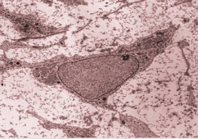 Imagem de microscópio de uma célula-tronco mesenquimal