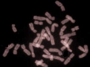 Imagem de cromossomos vistos em um microscópio eletrônico