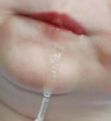 Boca de criança salivando