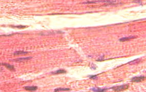 Imagem das estrias do miocárdio