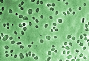 Imagem de microscópio mostrando uma colônia de arqueobactérias