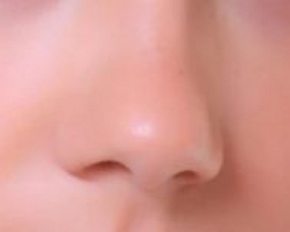 Foto de um nariz humano