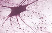 Imagem de uma célula nervosa (ampliada em microscópio)