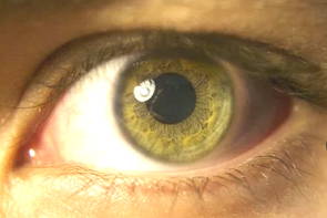 Foto de um olho humano