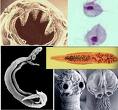 Parasitologia: ciência que estuda os parasitas