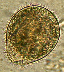 Imagem de um protozoário Balantidium coli 