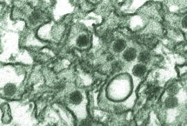Imagem de microscópio do Zika Vírus